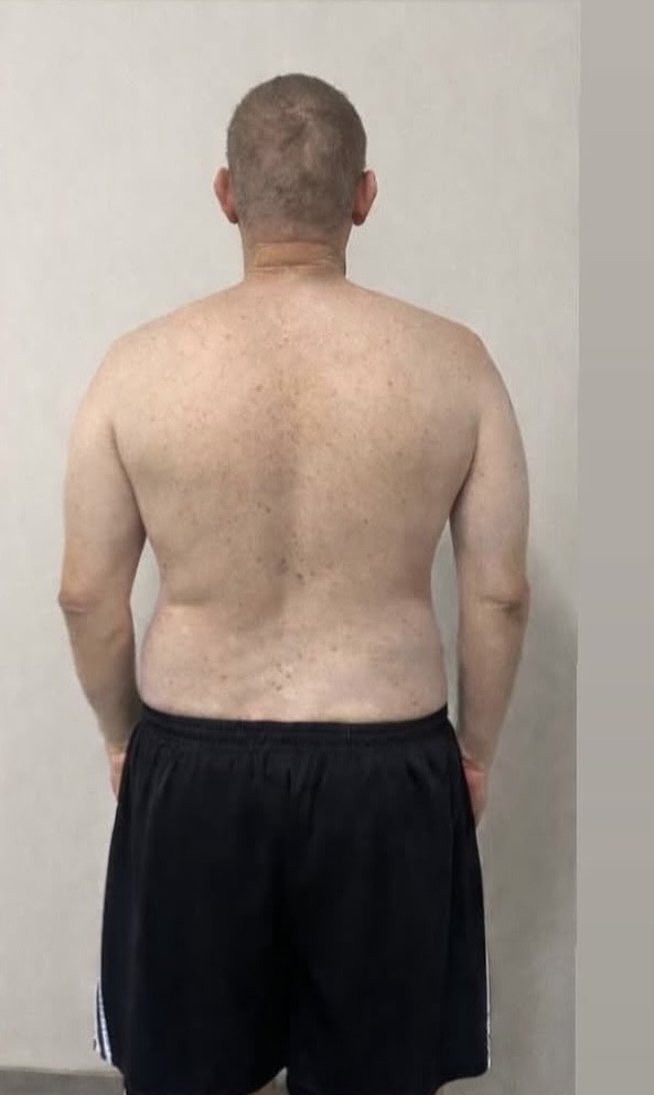 Registro postural quando o paciente chegou ao consultório